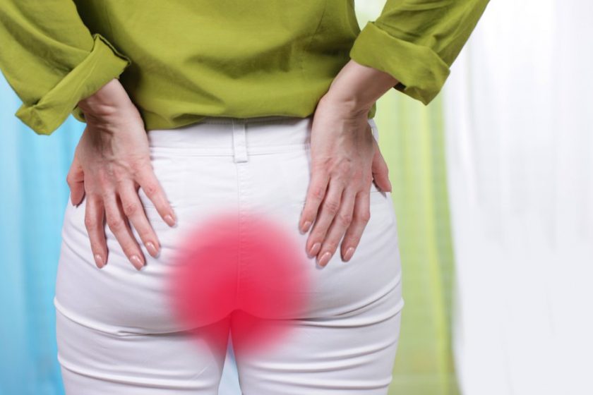 hemorrhoids