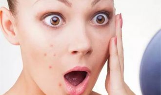 pimples